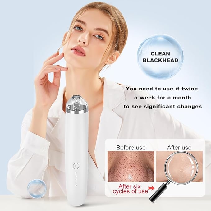 Blackhead Remover Pore Vacuum